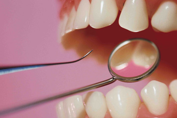 Scaling & Planing - Sugar Land TX Dentist Anderson Dental